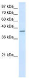 Poly(RC) Binding Protein 4 antibody, TA343896, Origene, Western Blot image 