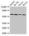 Aristaless Related Homeobox antibody, CSB-PA850418LA01HU, Cusabio, Western Blot image 