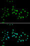 DNA Methyltransferase 3 Alpha antibody, A00136-1, Boster Biological Technology, Western Blot image 