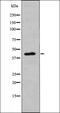 NDRG Family Member 2 antibody, orb335960, Biorbyt, Western Blot image 