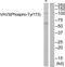 Vav Guanine Nucleotide Exchange Factor 3 antibody, PA5-39837, Invitrogen Antibodies, Western Blot image 