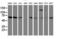 Folate Hydrolase 1 antibody, LS-C173829, Lifespan Biosciences, Western Blot image 