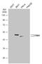 Tribbles homolog 1 antibody, GTX111960, GeneTex, Western Blot image 