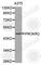 Prokineticin Receptor 2 antibody, A2960, ABclonal Technology, Western Blot image 