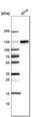 Lysosomal Associated Membrane Protein 1 antibody, AMAb91301, Atlas Antibodies, Western Blot image 