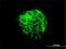 Junction Plakoglobin antibody, H00003728-M01, Novus Biologicals, Immunocytochemistry image 