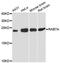 RAB7A antibody, LS-C747860, Lifespan Biosciences, Western Blot image 