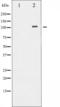 ATPase Na+/K+ Transporting Subunit Alpha 1 antibody, GTX52350, GeneTex, Western Blot image 