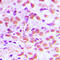 SUMO1 Activating Enzyme Subunit 1 antibody, LS-C353229, Lifespan Biosciences, Immunohistochemistry paraffin image 