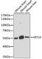 Keratin 14 antibody, A15069, ABclonal Technology, Western Blot image 