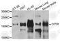 CF Transmembrane Conductance Regulator antibody, A8386, ABclonal Technology, Western Blot image 