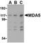 Interferon Induced With Helicase C Domain 1 antibody, NBP1-76761, Novus Biologicals, Western Blot image 
