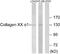 Collagen Type XX Alpha 1 Chain antibody, A14855, Boster Biological Technology, Western Blot image 