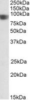 Nucleotide Binding Oligomerization Domain Containing 1 antibody, STJ70152, St John