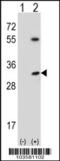 Serine/Threonine Kinase 16 antibody, 62-752, ProSci, Western Blot image 