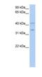 LIM and SH3 domain protein 1 antibody, NBP1-53148, Novus Biologicals, Western Blot image 