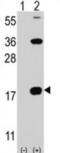 CD247 Molecule antibody, abx027825, Abbexa, Western Blot image 