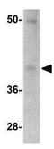 Programmed Cell Death 1 antibody, GTX17273, GeneTex, Western Blot image 