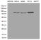 Tetratricopeptide repeat protein 7A antibody, M05538, Boster Biological Technology, Western Blot image 