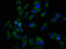 RALBP1 Associated Eps Domain Containing 1 antibody, LS-C674156, Lifespan Biosciences, Immunofluorescence image 