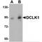 Doublecortin Like Kinase 1 antibody, MBS151052, MyBioSource, Western Blot image 