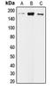 CAP-Gly Domain Containing Linker Protein 1 antibody, LS-C352810, Lifespan Biosciences, Western Blot image 