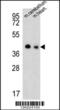 Solute Carrier Family 25 Member 19 antibody, 61-865, ProSci, Western Blot image 