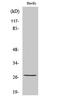 Heat Shock Protein Family B (Small) Member 1 antibody, STJ90296, St John