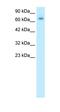 PARP2 antibody, orb329744, Biorbyt, Western Blot image 