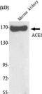 Angiotensin I Converting Enzyme antibody, M00251-2, Boster Biological Technology, Western Blot image 