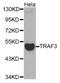 Eukaryotic Translation Initiation Factor 3 Subunit E antibody, abx004851, Abbexa, Western Blot image 