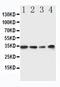MYD88 Innate Immune Signal Transduction Adaptor antibody, PA1660, Boster Biological Technology, Western Blot image 