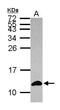 S100 Calcium Binding Protein A6 antibody, GTX121460, GeneTex, Western Blot image 