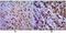 Cyclin Dependent Kinase 1 antibody, GTX82995, GeneTex, Immunohistochemistry paraffin image 