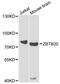 ZBTB20 antibody, A04274, Boster Biological Technology, Western Blot image 