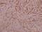 SEM3A antibody, A01761, Boster Biological Technology, Immunohistochemistry paraffin image 