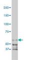 P21 (RAC1) Activated Kinase 1 antibody, H00005058-M02, Novus Biologicals, Western Blot image 