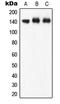 Nitric Oxide Synthase 3 antibody, GTX32227, GeneTex, Western Blot image 