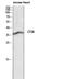 Cathepsin B antibody, STJ97650, St John