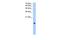 Paired Immunoglobin Like Type 2 Receptor Alpha antibody, GTX46384, GeneTex, Western Blot image 