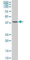 Sushi Domain Containing 6 antibody, H00009766-B01P, Novus Biologicals, Western Blot image 