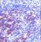 Synaptosome Associated Protein 23 antibody, LS-C161337, Lifespan Biosciences, Immunohistochemistry paraffin image 