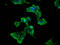 Serine/threonine-protein kinase WNK3 antibody, LS-C682338, Lifespan Biosciences, Immunofluorescence image 