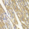 Tyrosinase antibody, 14-493, ProSci, Immunohistochemistry paraffin image 