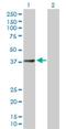 GTP-specific succinyl-CoA synthetase subunit beta antibody, H00008801-B01P, Novus Biologicals, Western Blot image 