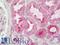 NADPH Oxidase 4 antibody, LS-B12123, Lifespan Biosciences, Immunohistochemistry frozen image 