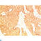 p53 antibody, LS-C813660, Lifespan Biosciences, Immunohistochemistry paraffin image 