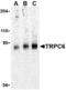 Transient Receptor Potential Cation Channel Subfamily C Member 6 antibody, MBS150882, MyBioSource, Western Blot image 