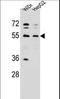 Asparaginyl-TRNA Synthetase antibody, LS-C164748, Lifespan Biosciences, Western Blot image 
