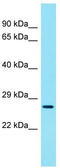 Coiled-Coil Domain Containing 59 antibody, TA331718, Origene, Western Blot image 